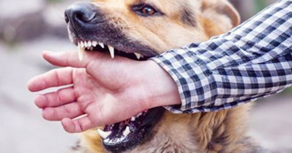 Cần siết chặt hơn nữa quy định về việc nuôi chó để hạn chế tình trạng chó tấn công người. Ảnh: TL